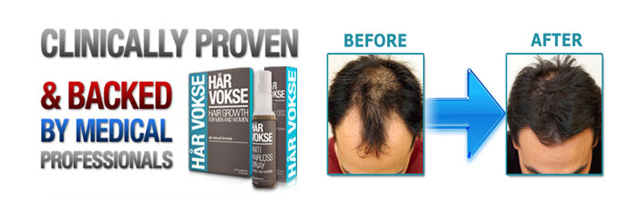 harvokse hair loss treatment