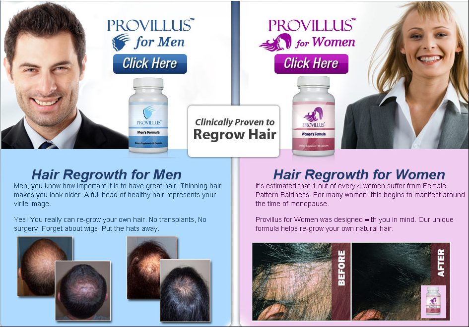 provillus hairloss remedy review